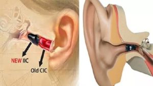 سمعک نامرئی IIC