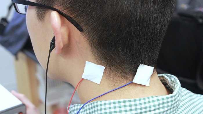 روش انجام درمان وزوز گوش با تحریک الکتریکی عصب واگ