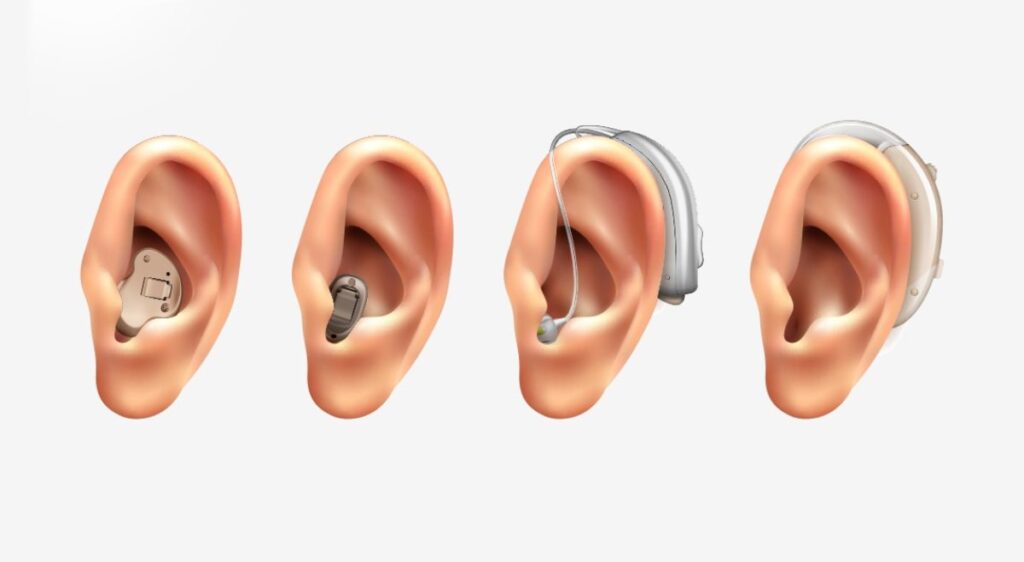 وسایل کمک شنوایی